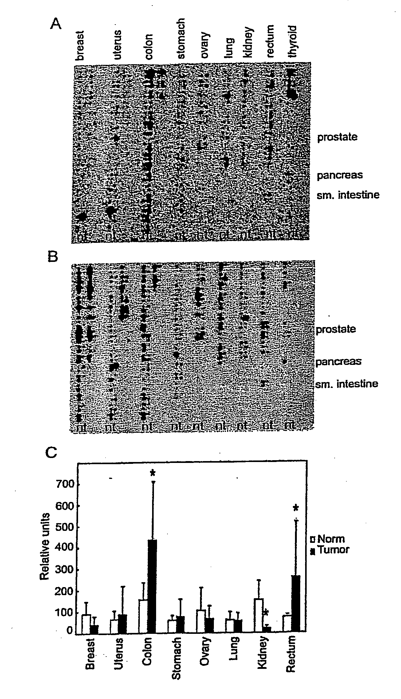 Materials and methods for colorectal cancer screening, diagnosis and therapy