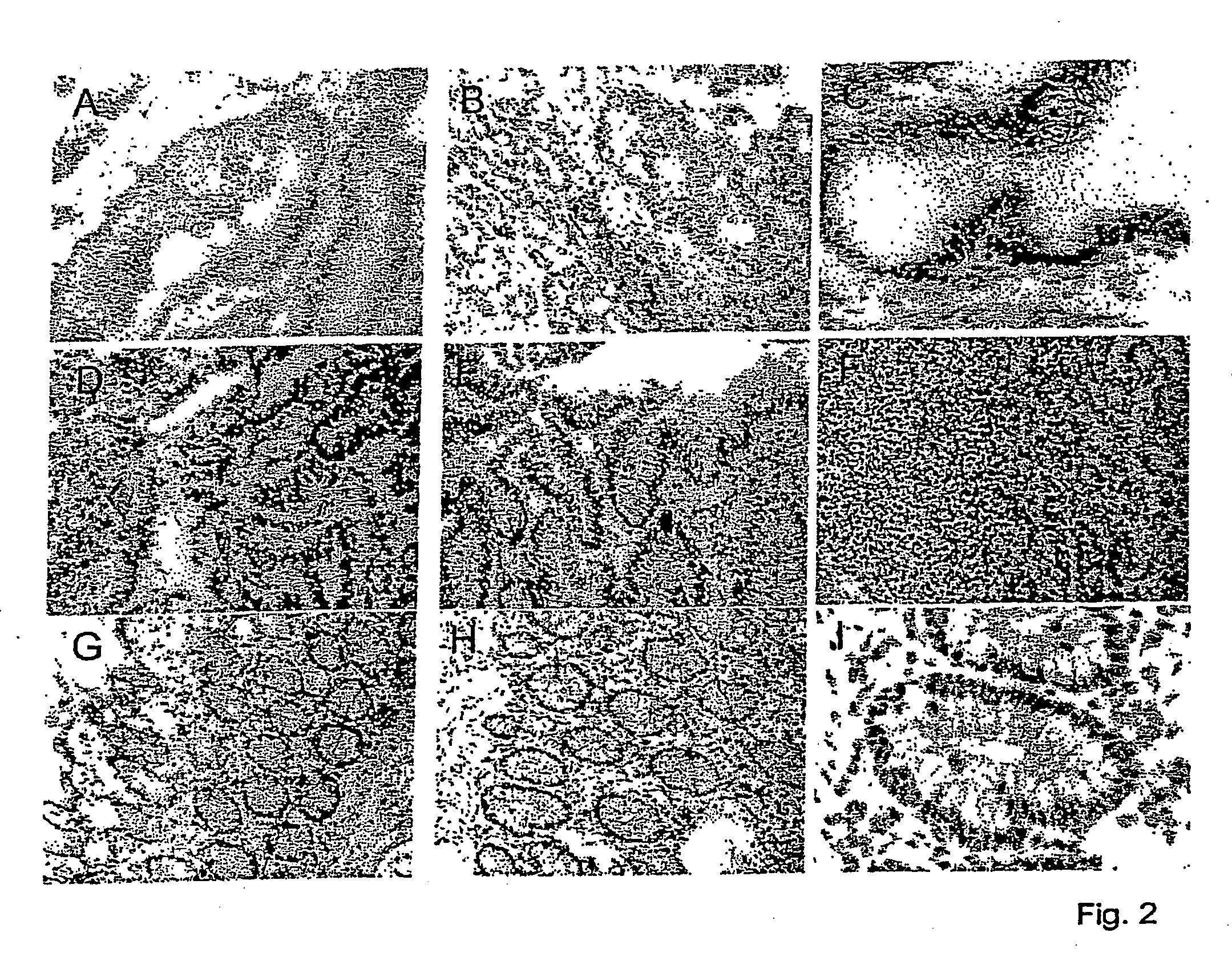 Materials and methods for colorectal cancer screening, diagnosis and therapy