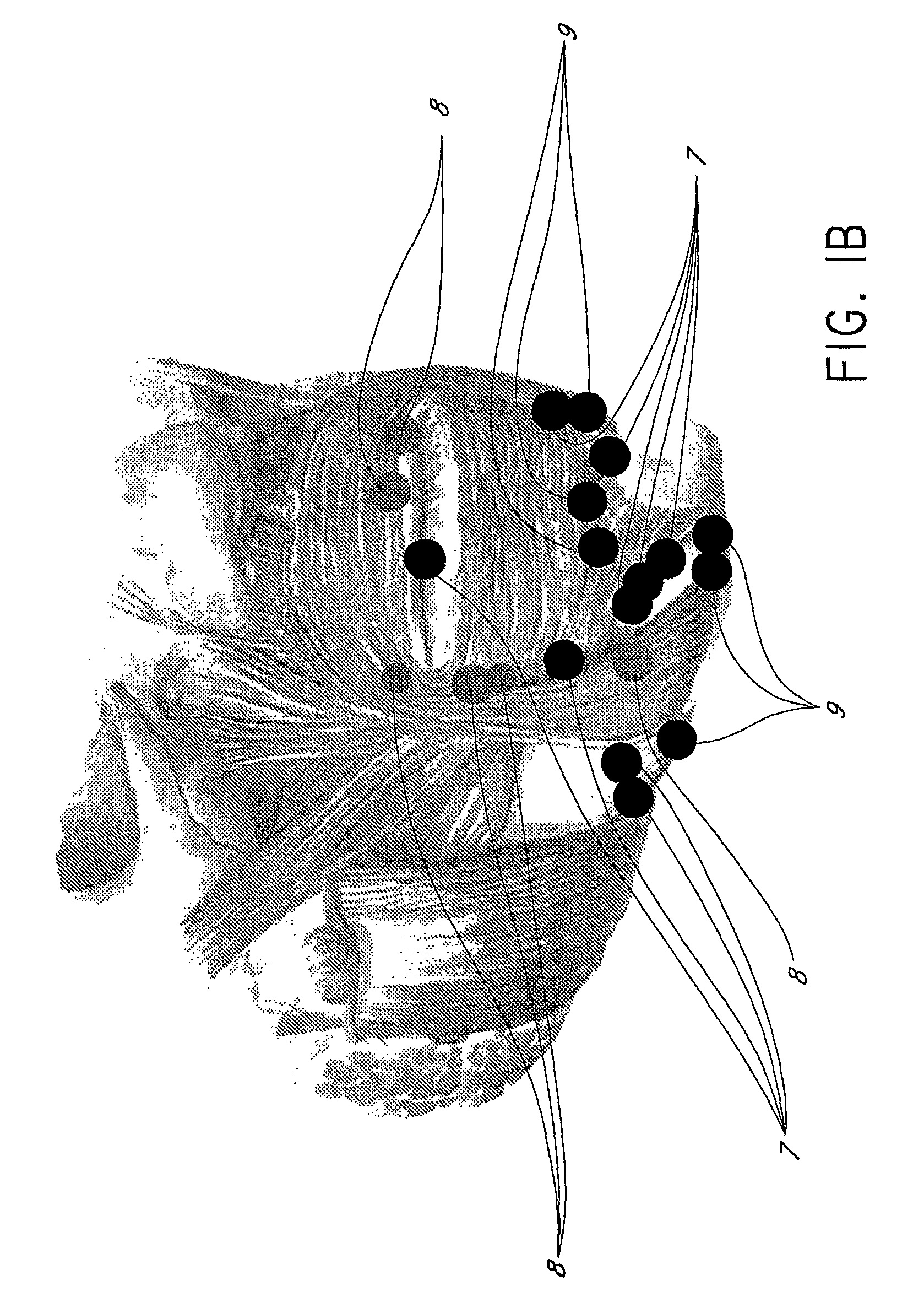 Methods for Identifying Areas of a Subject's Skin that Appear to Lack Volume