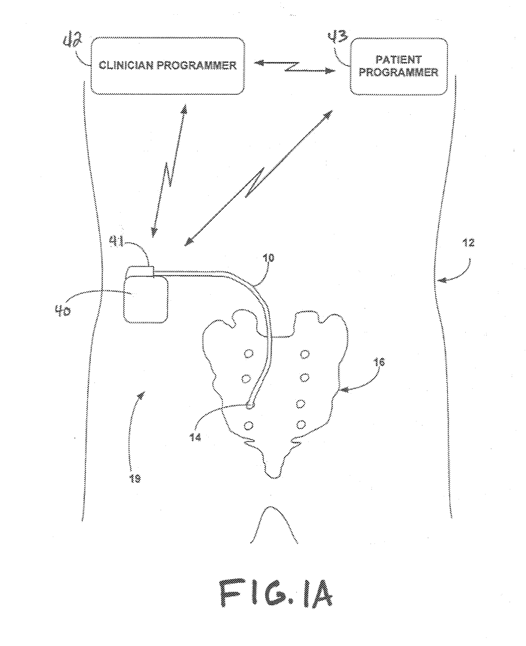Implantable Medical Electrical Stimulation Lead Fixation Method and Apparatus