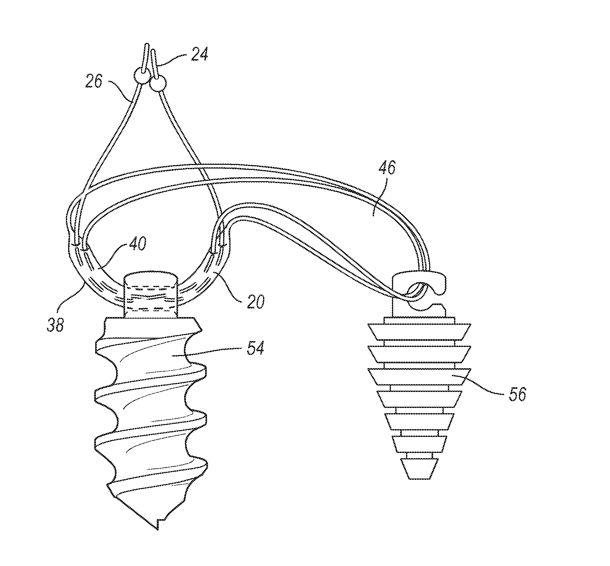 Method and apparatus for coupling anatomical features