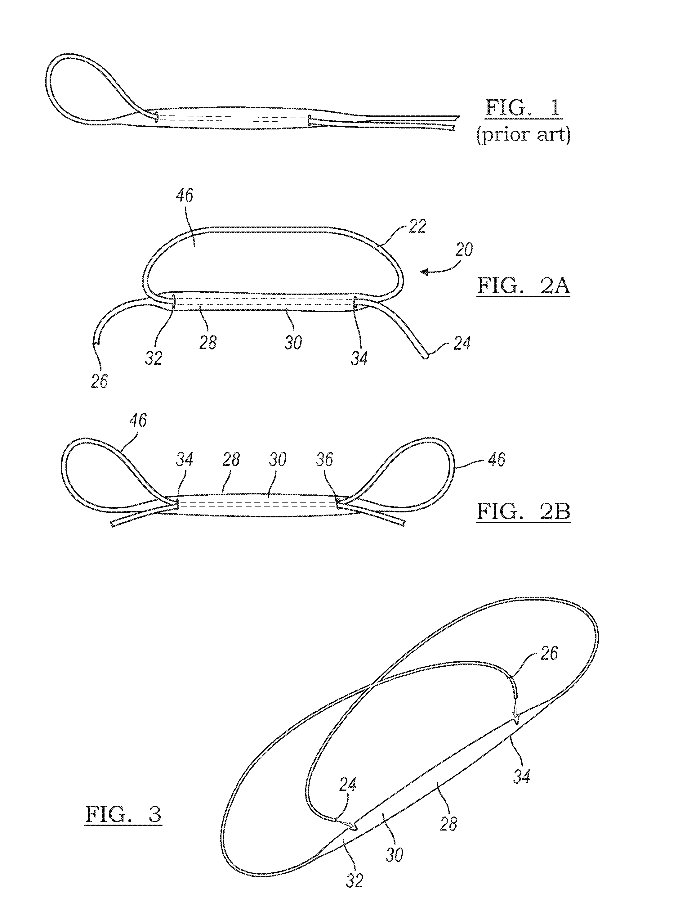 Method and apparatus for coupling anatomical features