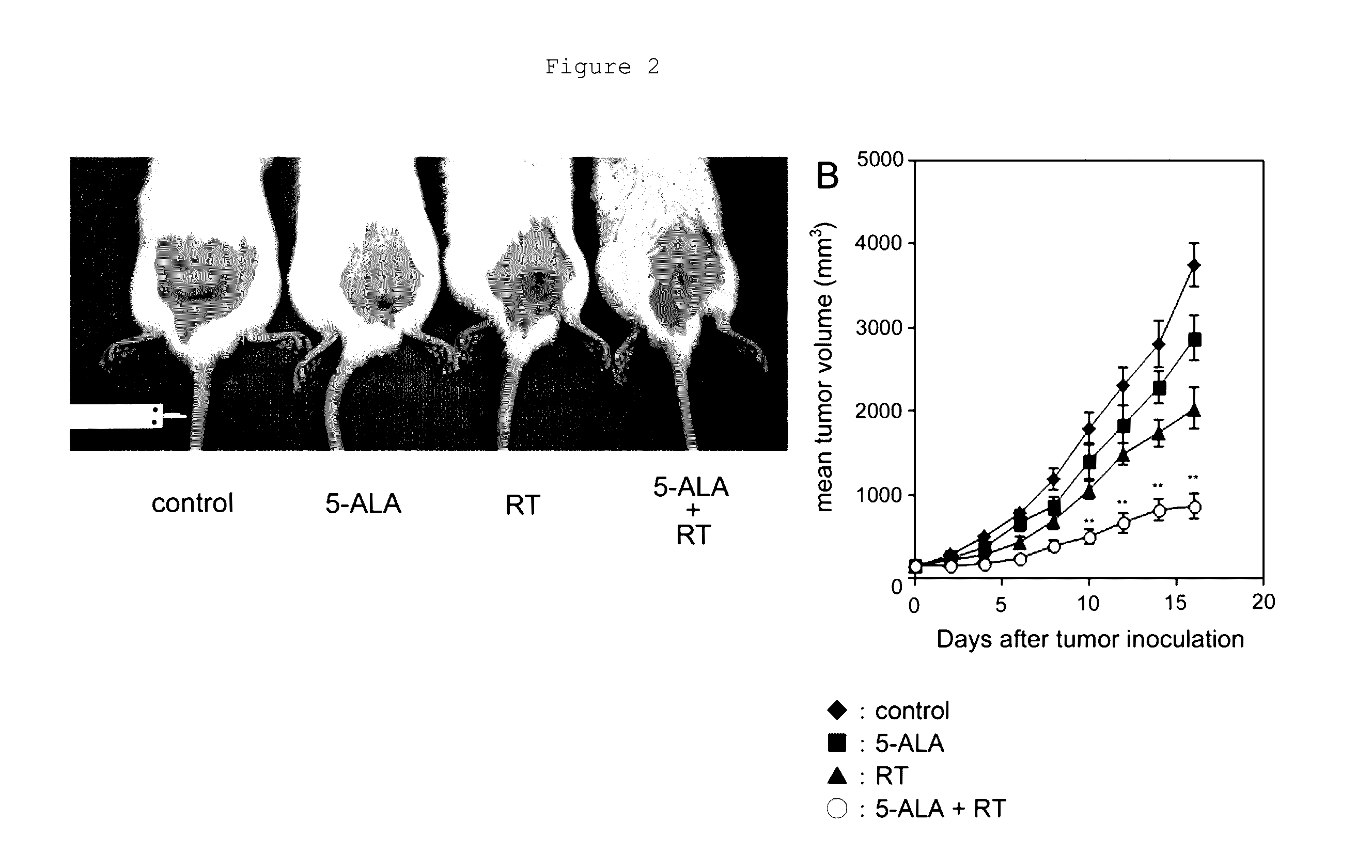 Composition for inducing tumor immunity