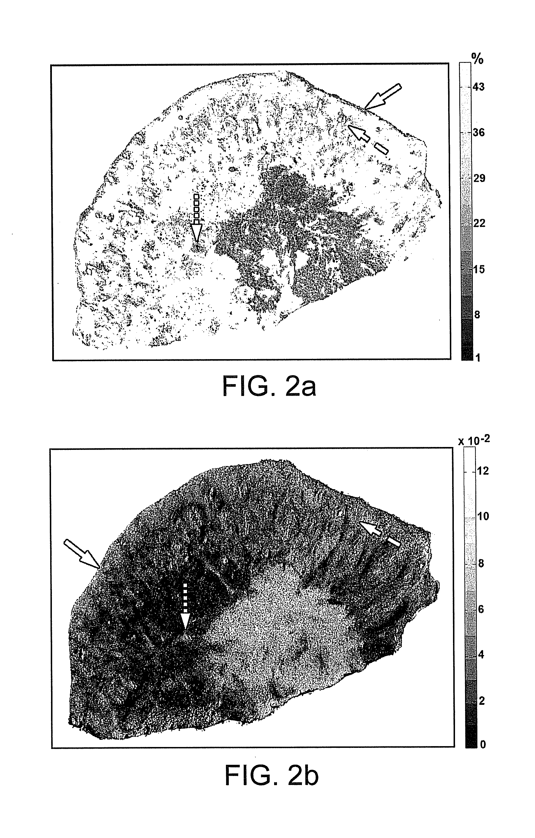 Method and apparatus for multimodal imaging of biological tissue