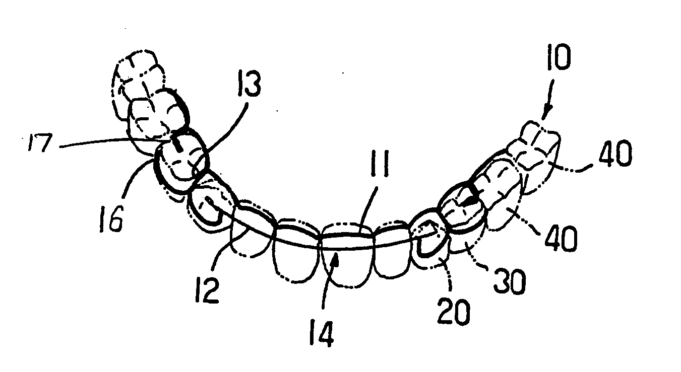 Orthodontic wire retainer