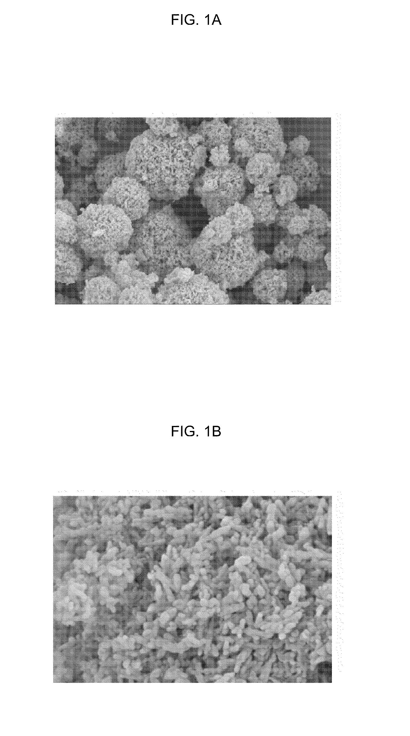 Active Agent Loaded Uniform, Rigid, Spherical, Nanoporous Calcium Phosphate Particles and Methods of Making and Using the Same