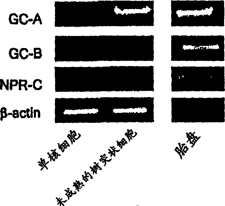 Medicinal composition for preventing or treating Th1 type immunological disease