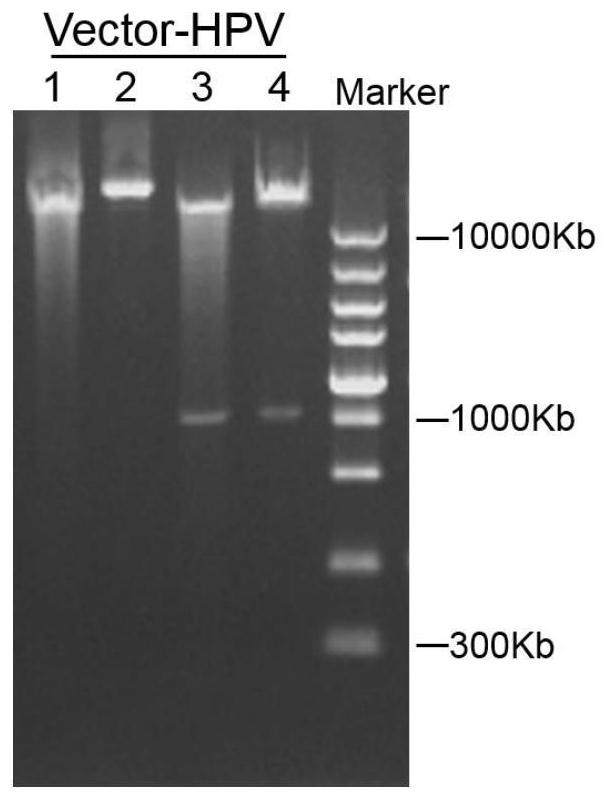 Preparation method and application of immortalized human CD34 &lt;+&gt;CD38&lt;-&gt; hematopoietic stem cell line