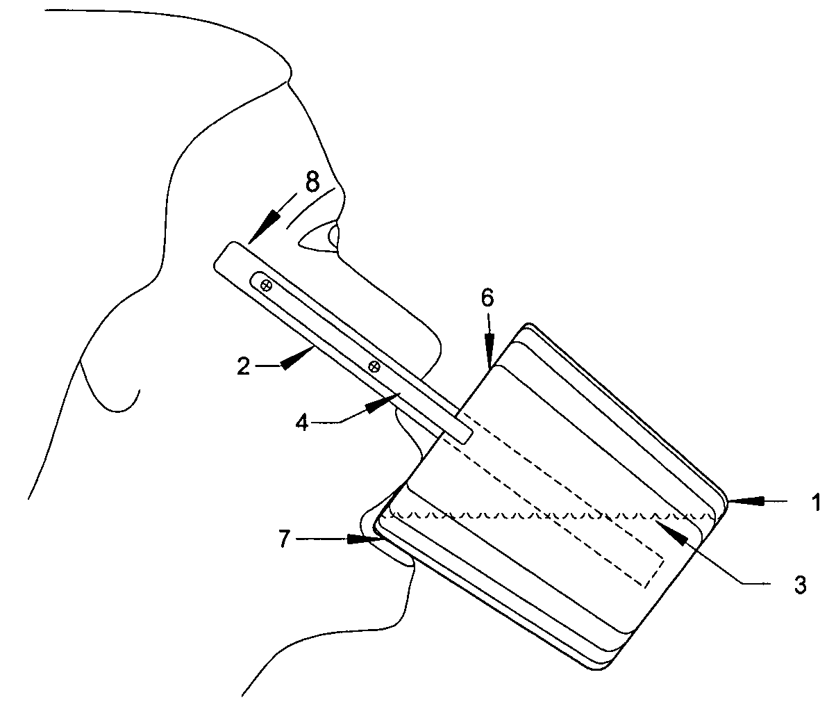 Device for the treatment of hiccups