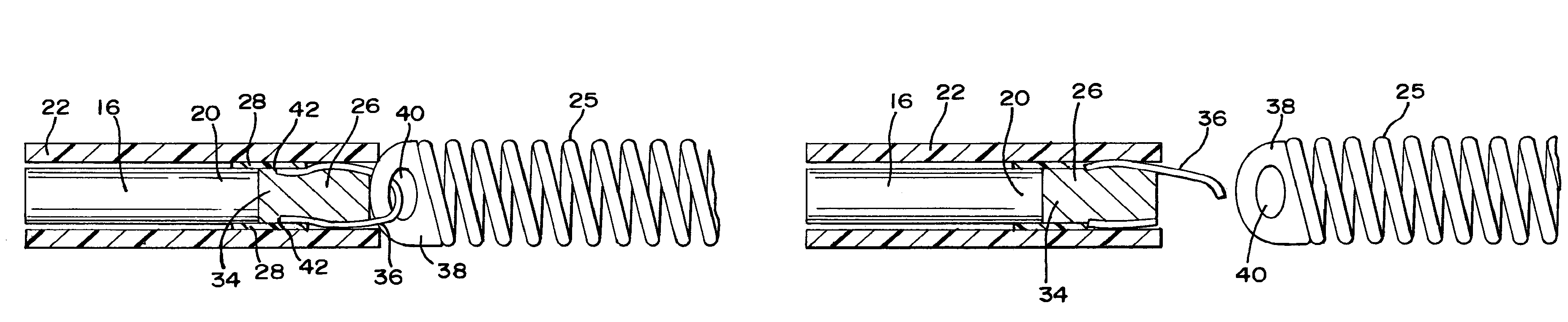 Laser-based vascular occlusion device detachment system