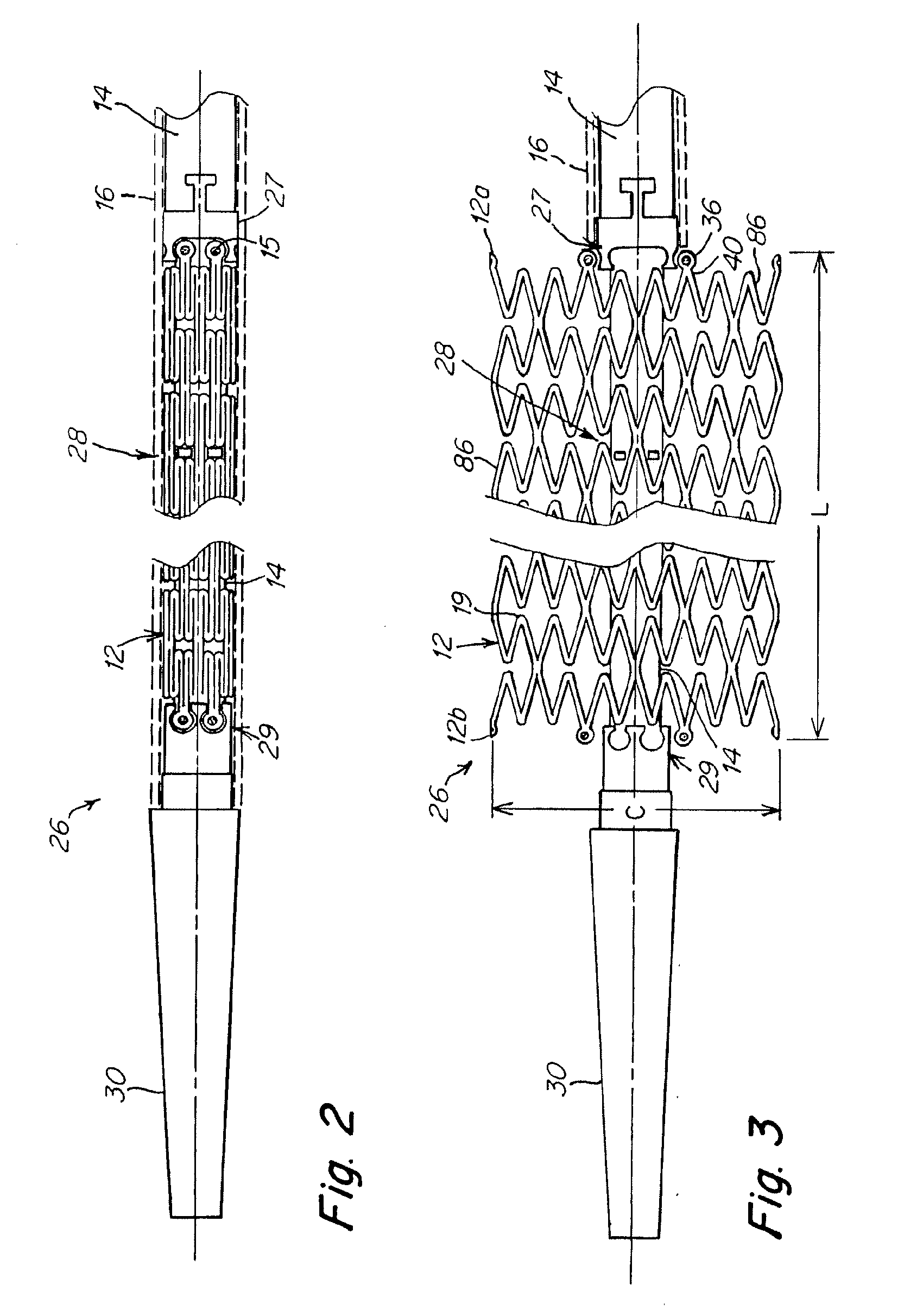Implant and delivery system with multiple marker interlocks