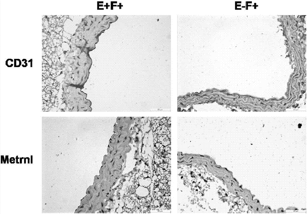 Application of Metrnl protein or gene in treatment of endothelial function impairment