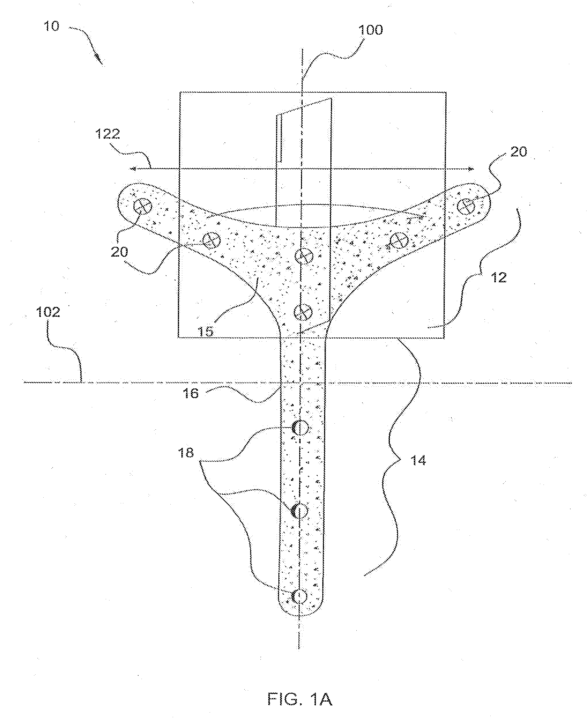 Temporal brow lifting and fixation device