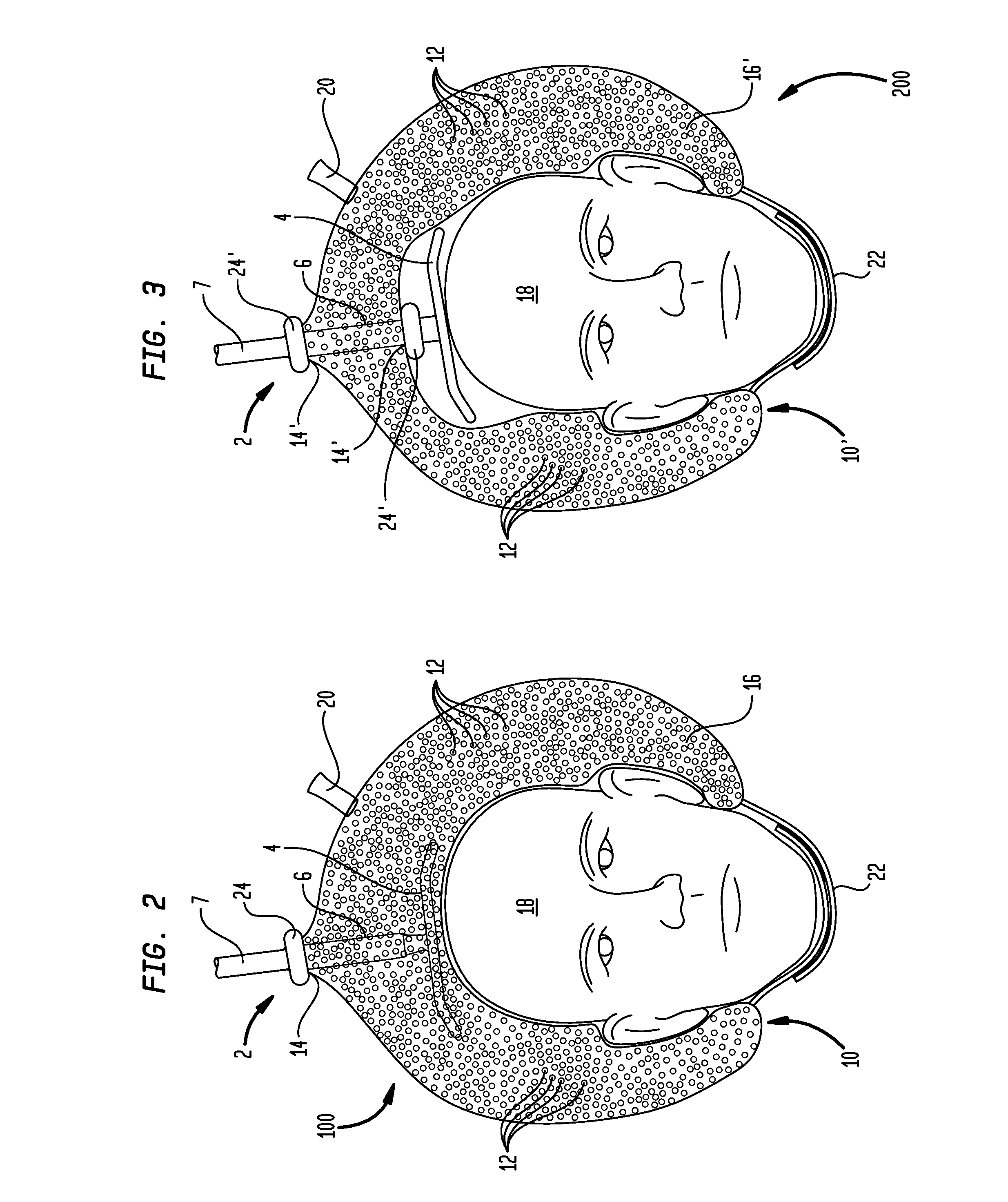 Securing a TMS coil to the patient's head