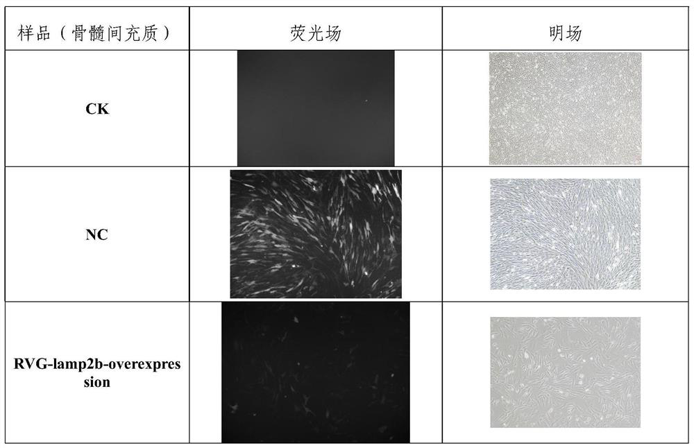 Application of mir-486-3p in the preparation of products for the treatment of neuroinflammation caused by sah