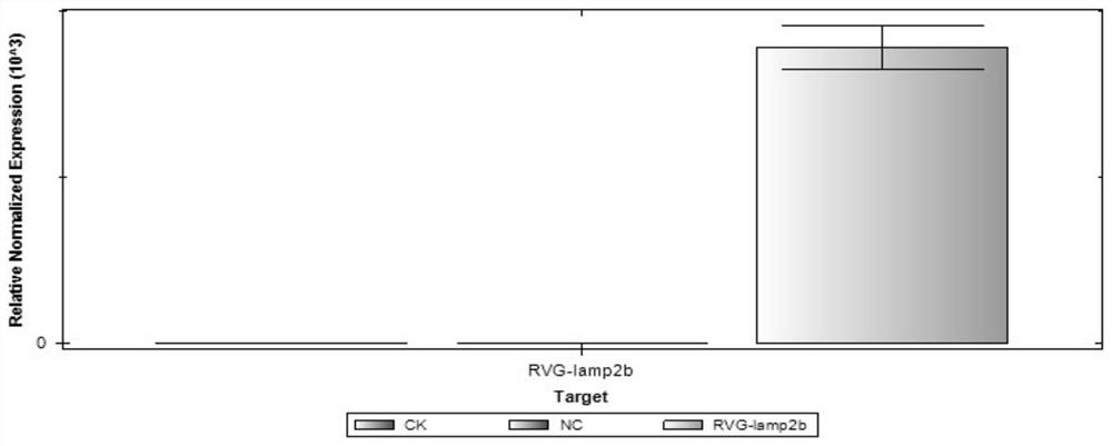 Application of mir-486-3p in the preparation of products for the treatment of neuroinflammation caused by sah