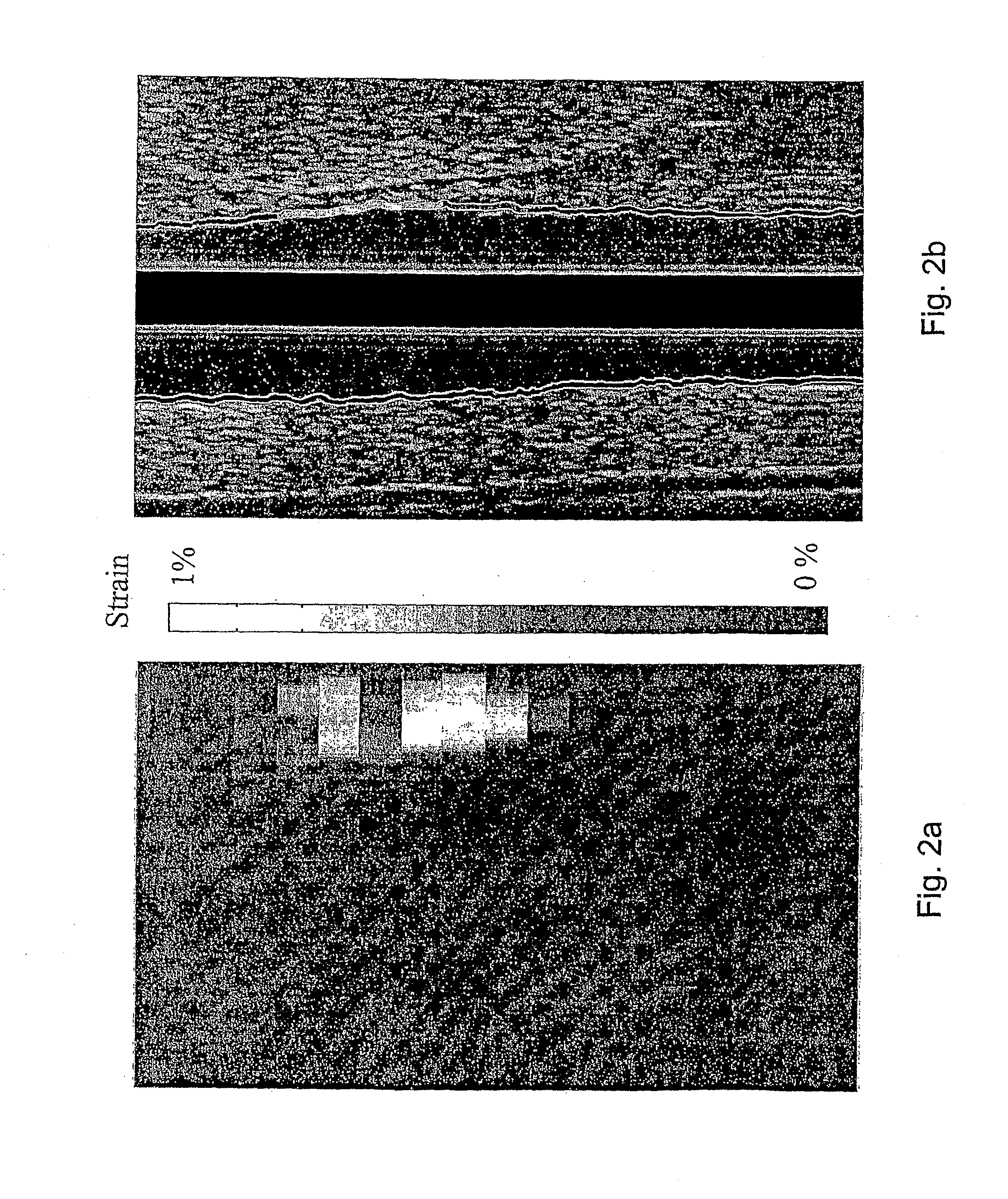 Three-Dimensional Tissue Hardness Imaging