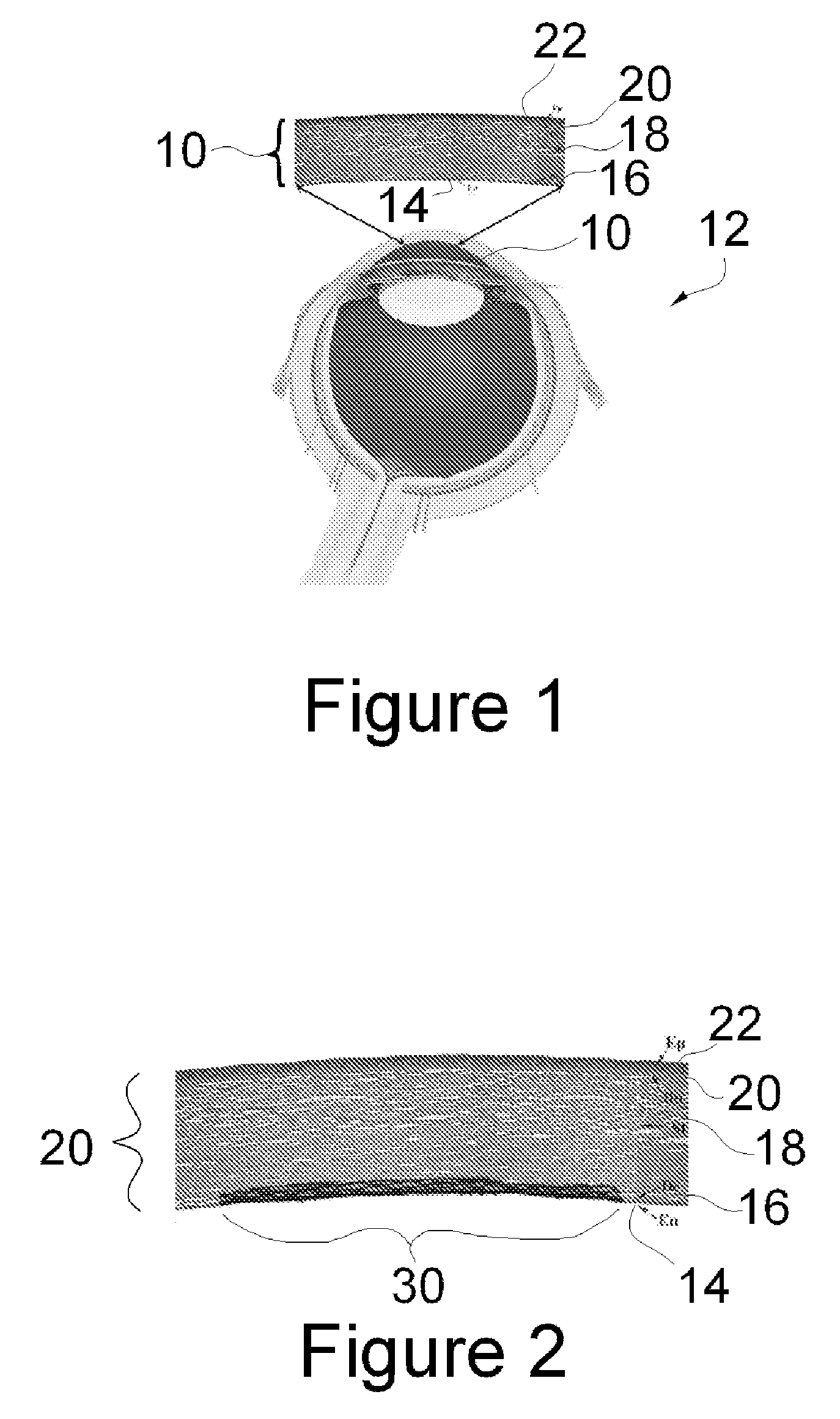 Apparatus and method for endothelial keratoplasty donor tissue transport and delivery