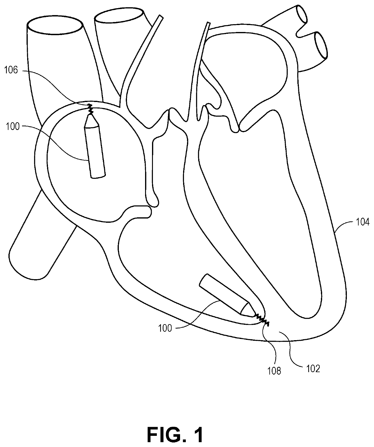 Header assembly having threadless interconnection