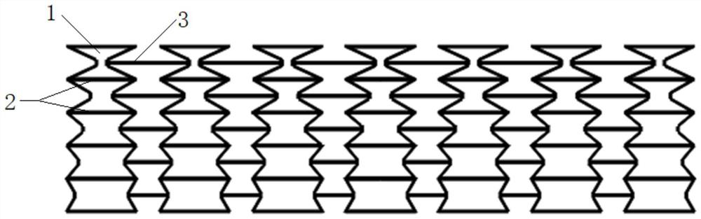 A stent suitable for the curved part of the urethra