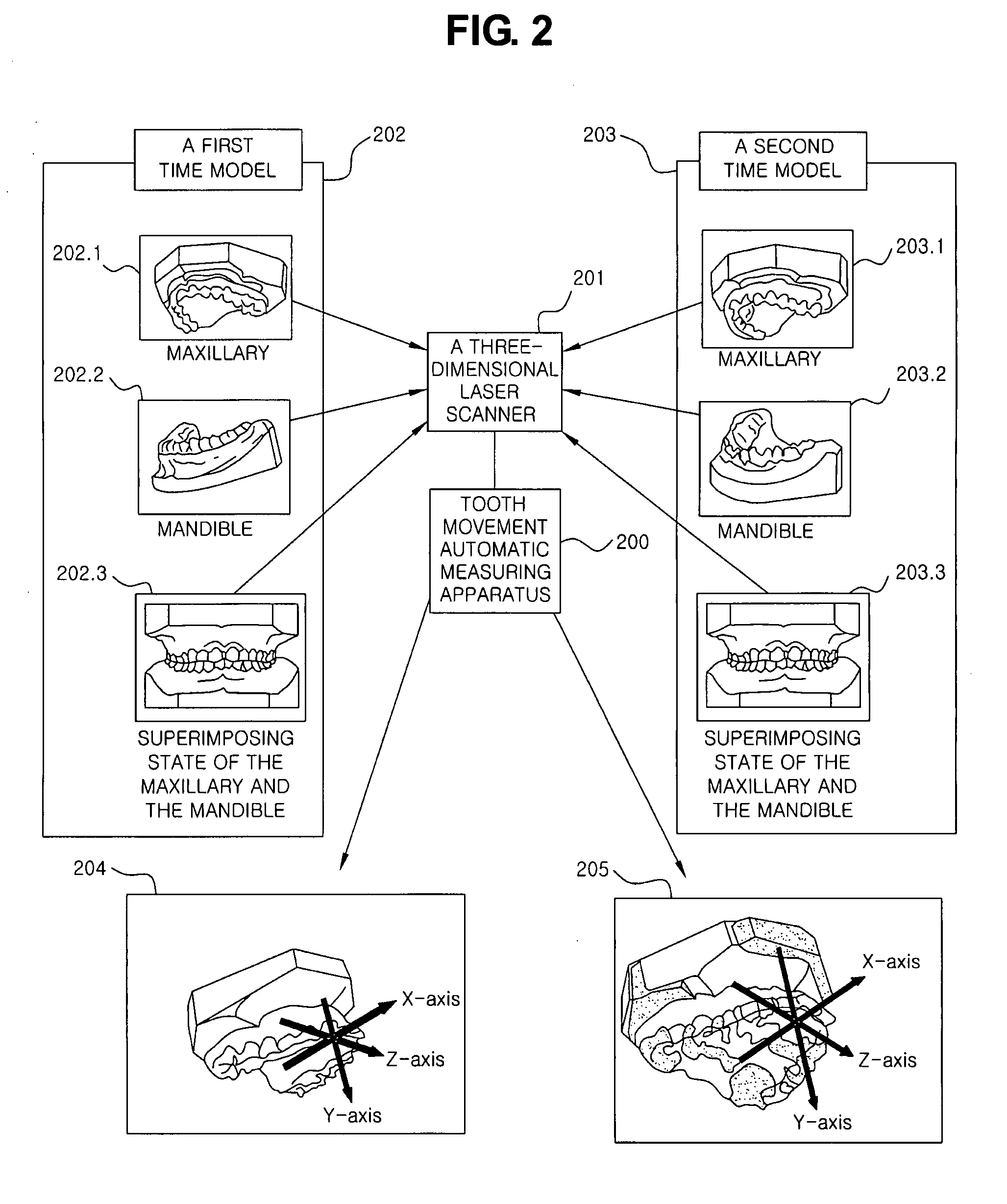 Automatic tooth movement measuring method employing three dimensional reverse engineering technique