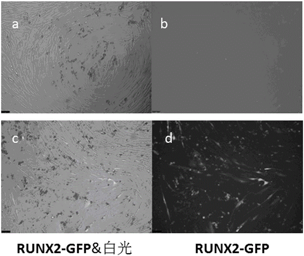 Culture system for promoting transdifferentiation of human skin fibroblasts to osteoblasts