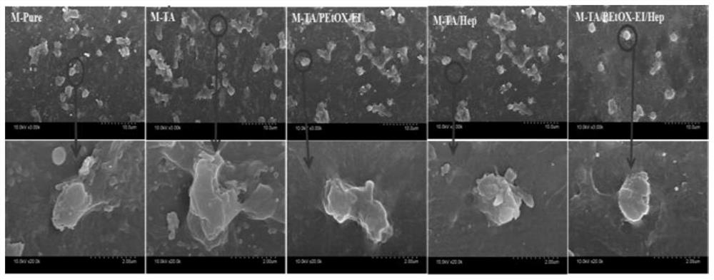 A hemodialysis membrane for intervening oxidative stress and anticoagulation, its preparation method and application