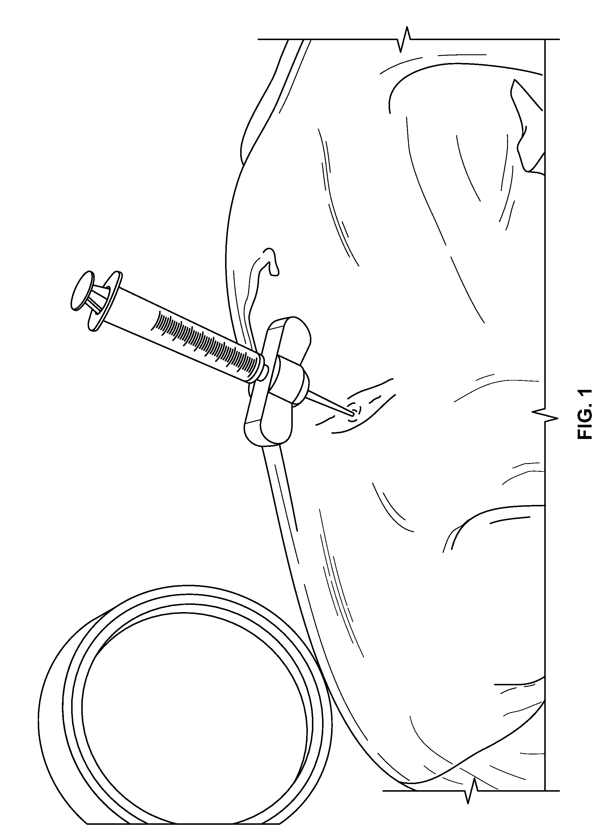 Compositions and methods for treating the vertebral column