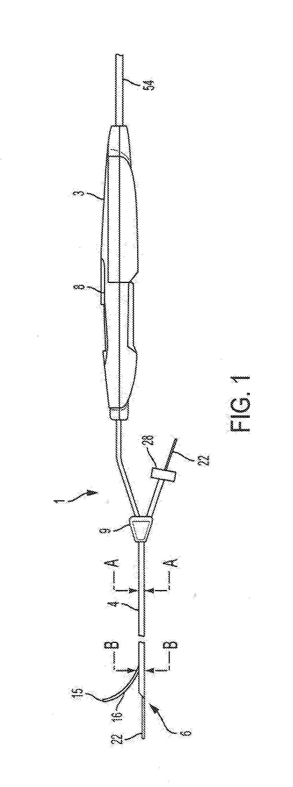 Endoluminal fluid delivery device and method