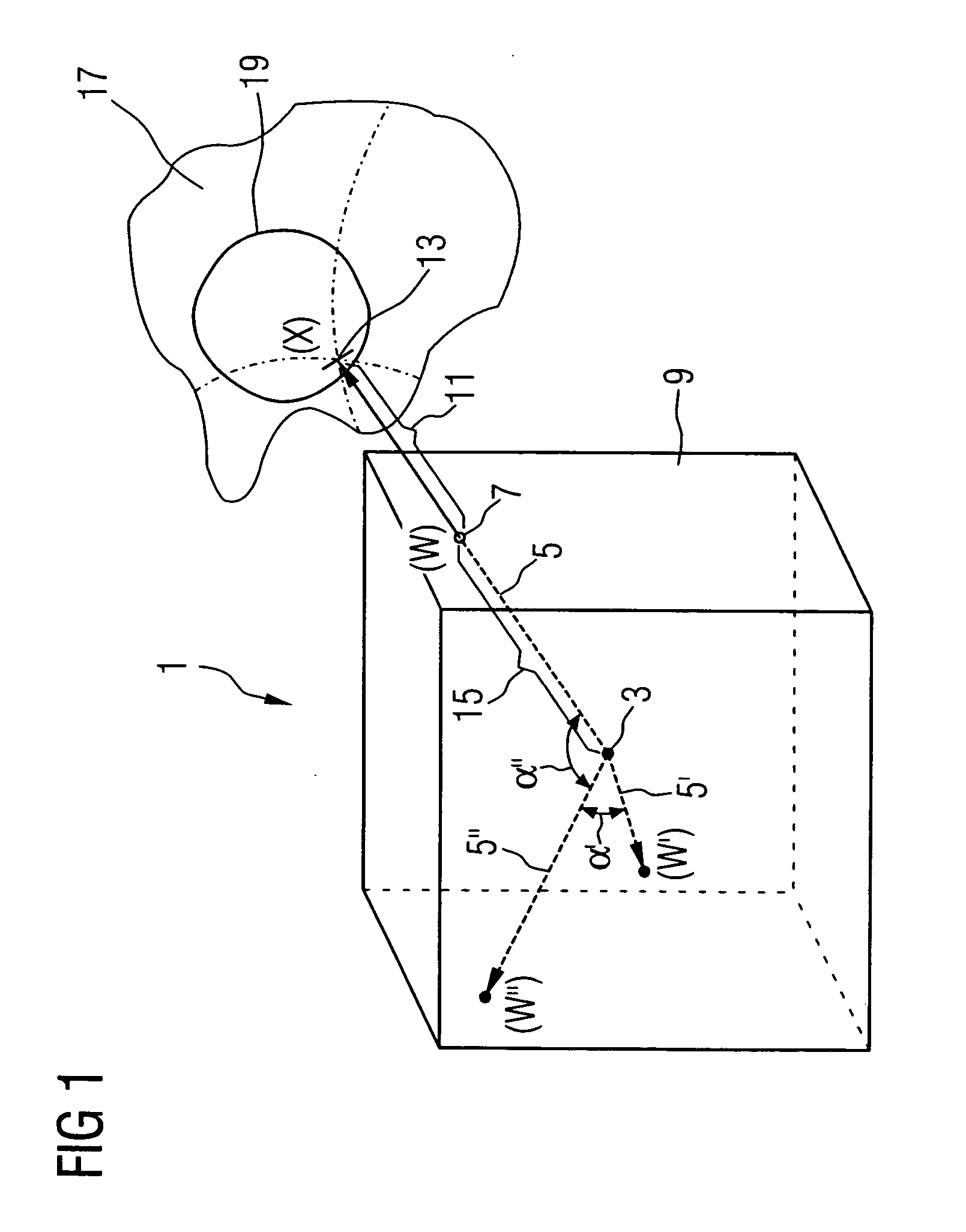 Method for medical 3D image display and processing, computed tomograph, workstation and computer program product