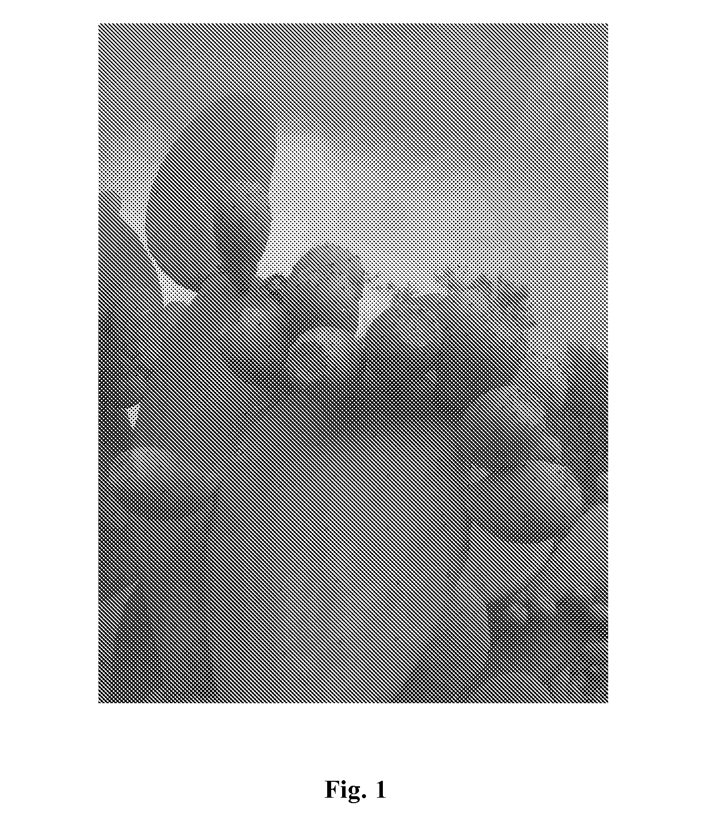 Compositions for the treatment of gastro-esophageal reflux disease (GERD)