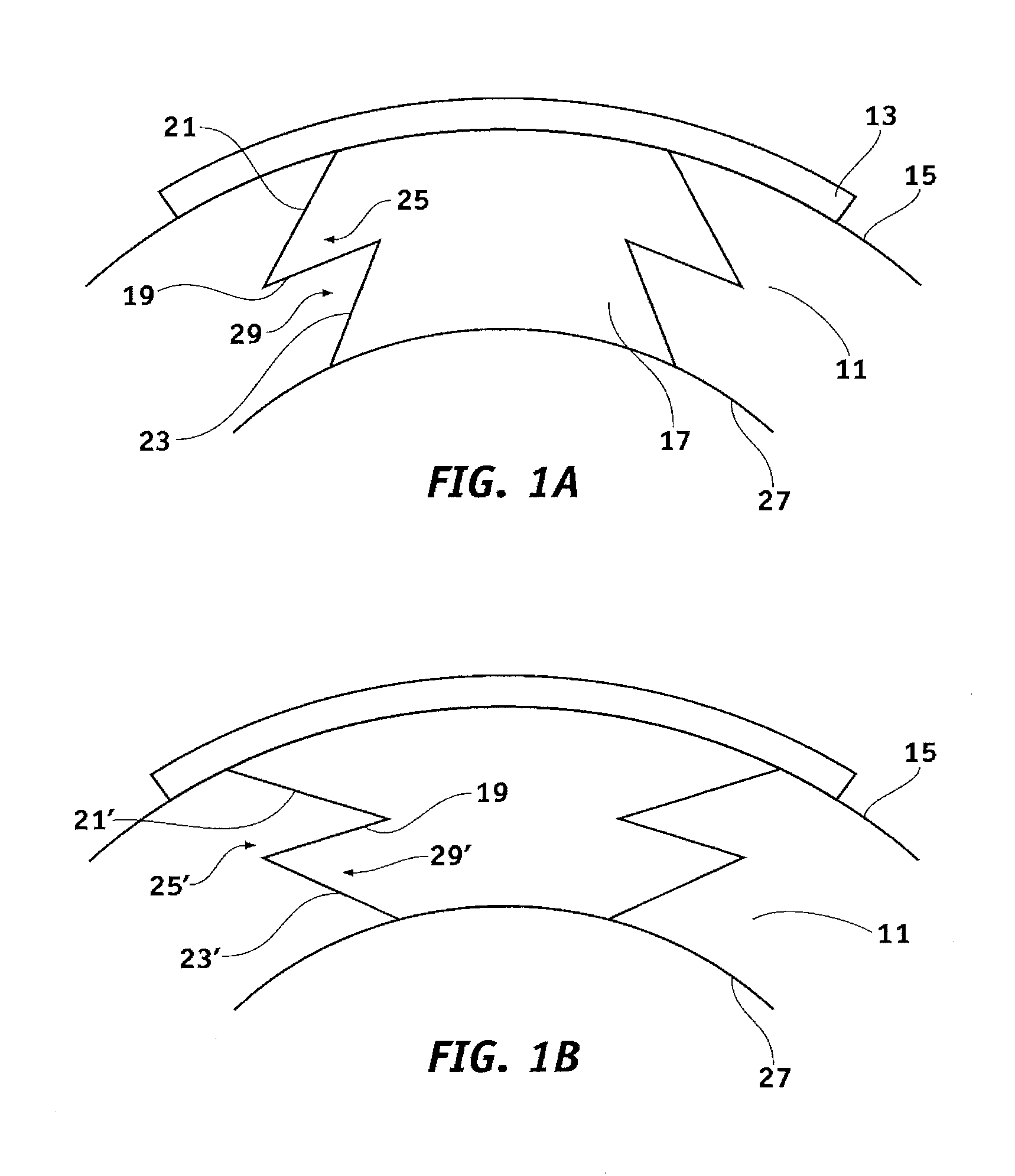System and method for resecting corneal tissue