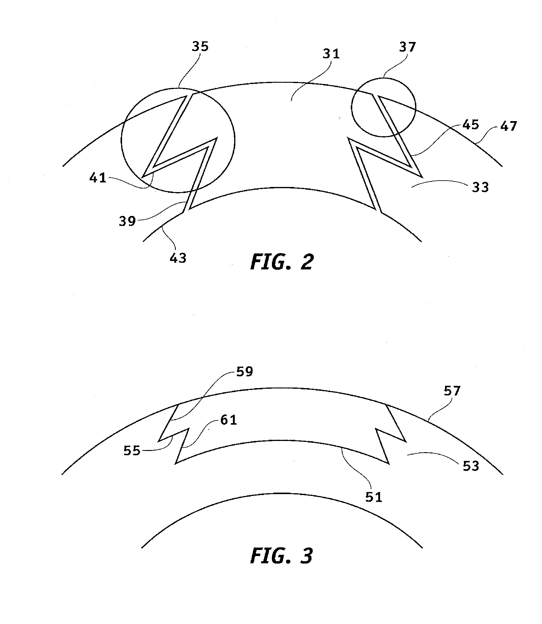 System and method for resecting corneal tissue