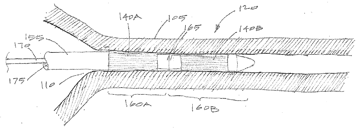 Systems and methods for female contraception