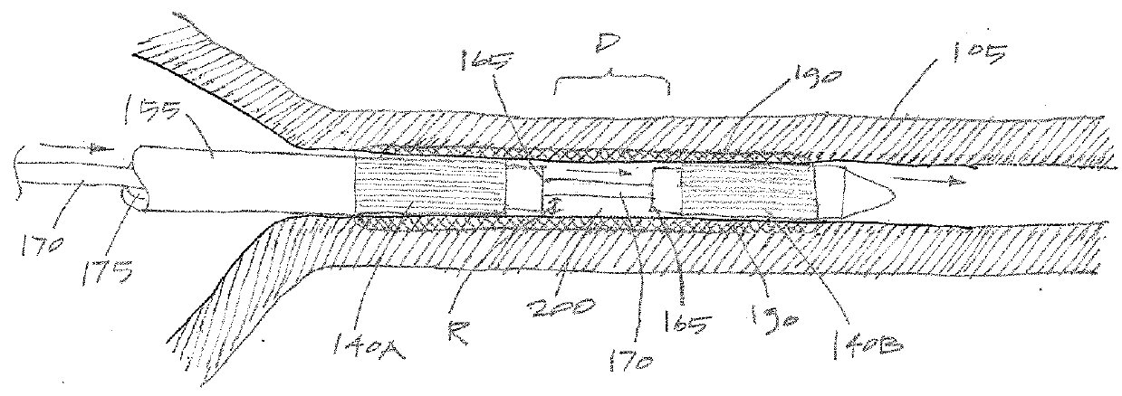 Systems and methods for female contraception