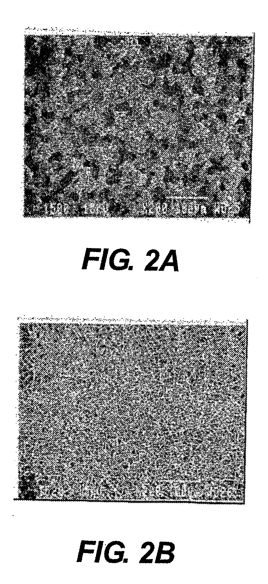 Treatment for high pressure bleeding