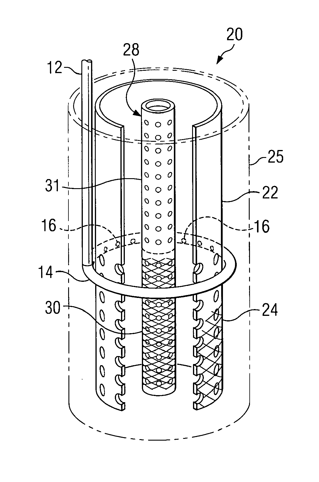 Radial flow filter with traveling spray device