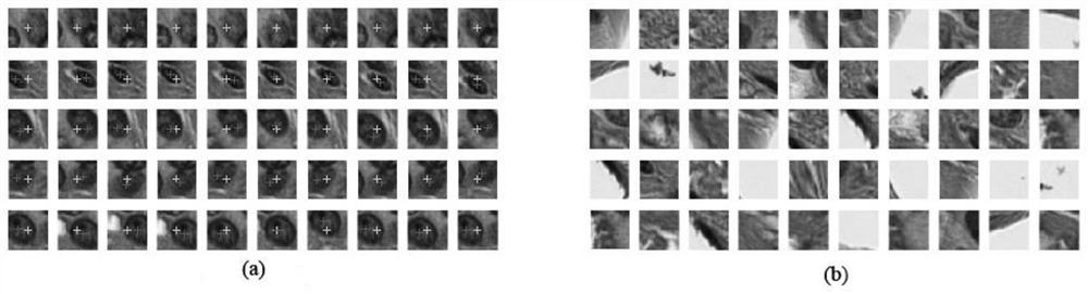 Iterative correction-based histopathologic image cell nucleus detection method and device