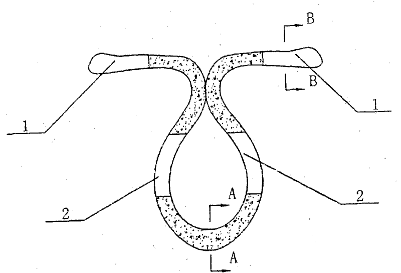 A new birth control ring