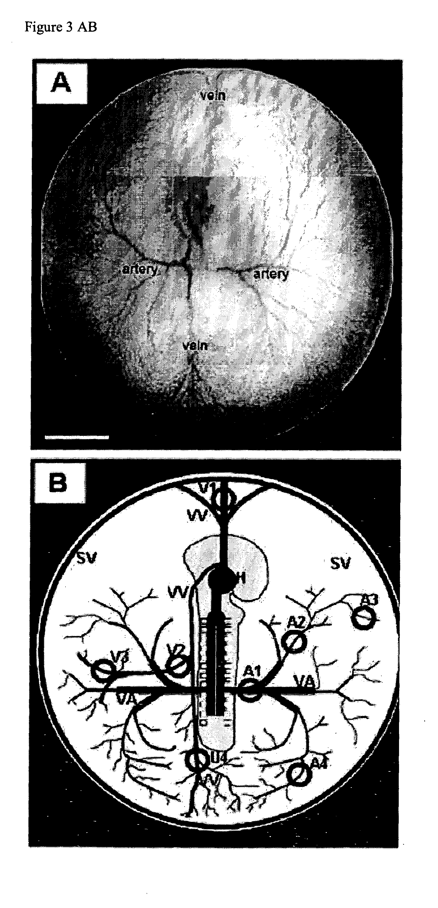Method and device for monitoring and improving arteriogenesis