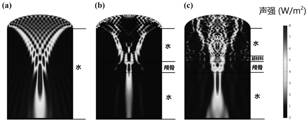 A Double Negative Acoustic Metamaterial Based on Mie Resonance for Transcranial Ultrasound Imaging
