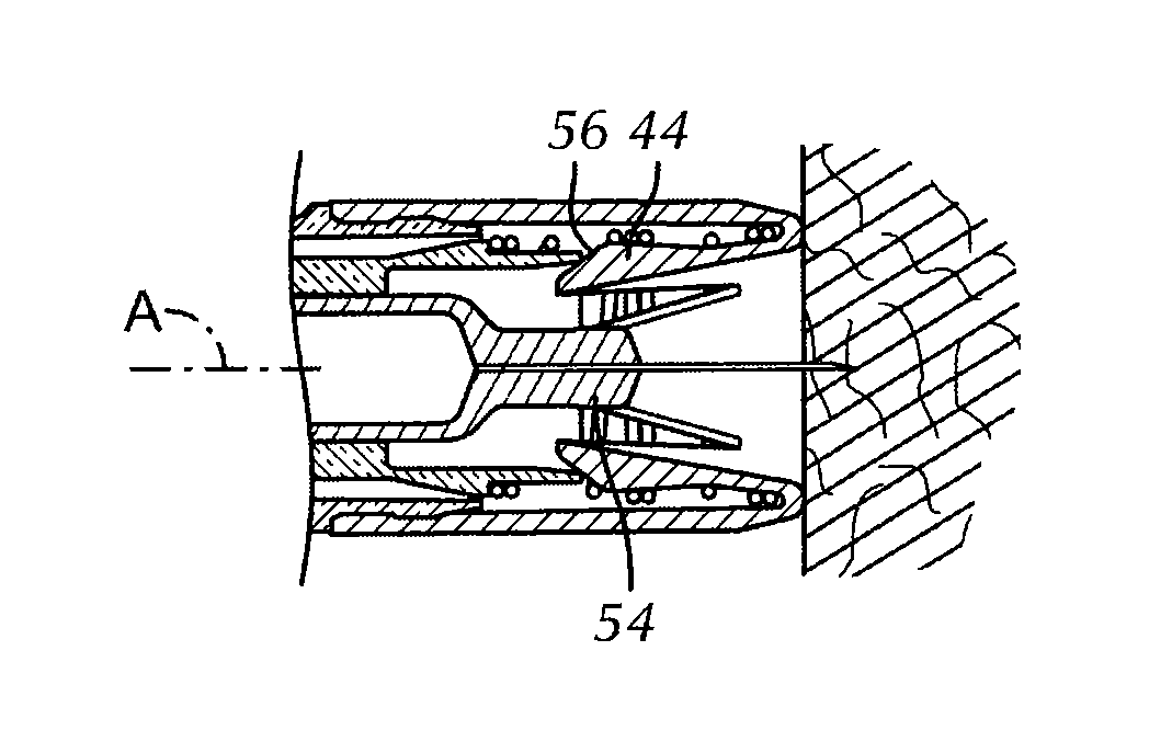 Automatic Injection Mechanism with Frontal Buttress