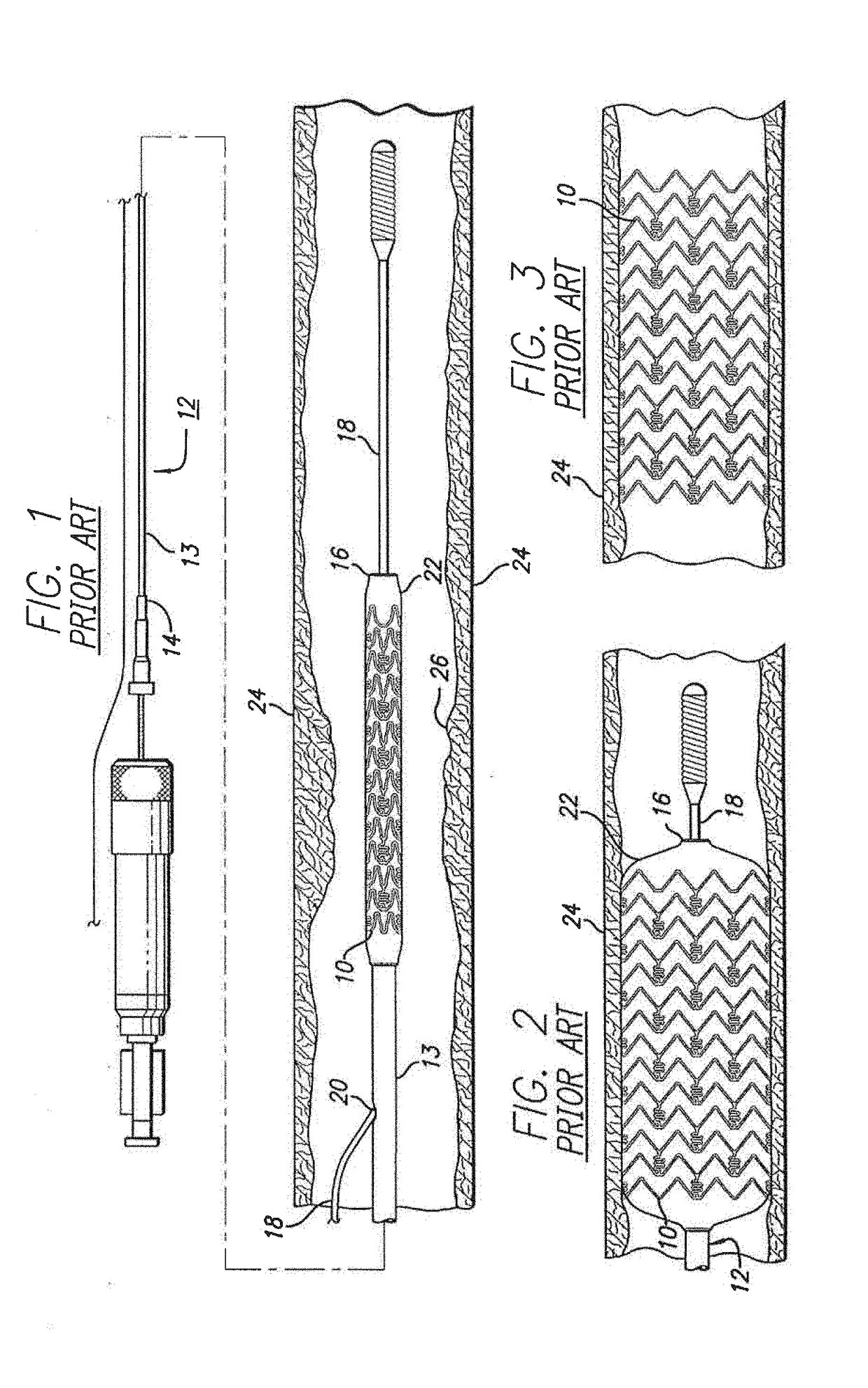 Intravascular stent having high fatigue performance