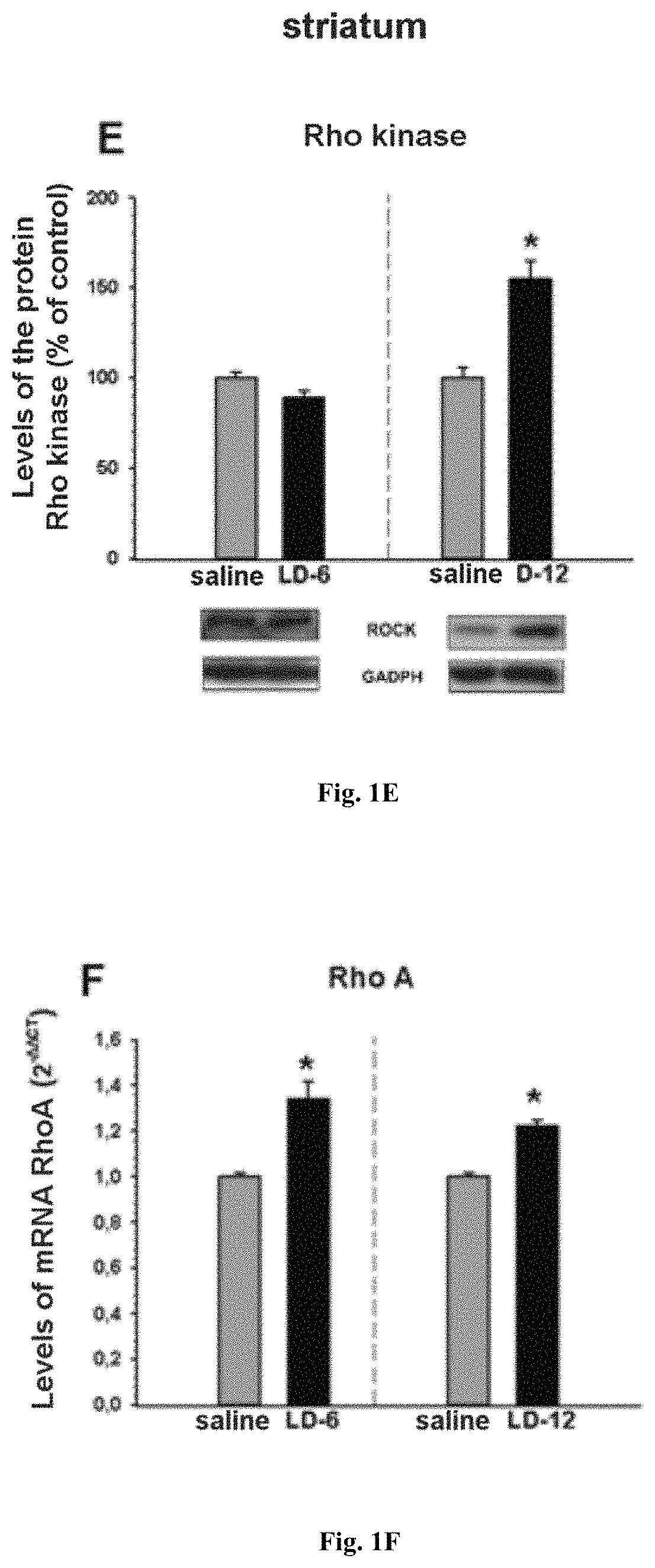 Pharmaceutical composition for use in the prophylactic and/or therapeutic treatment of L-DOPA-induced dyskinesia