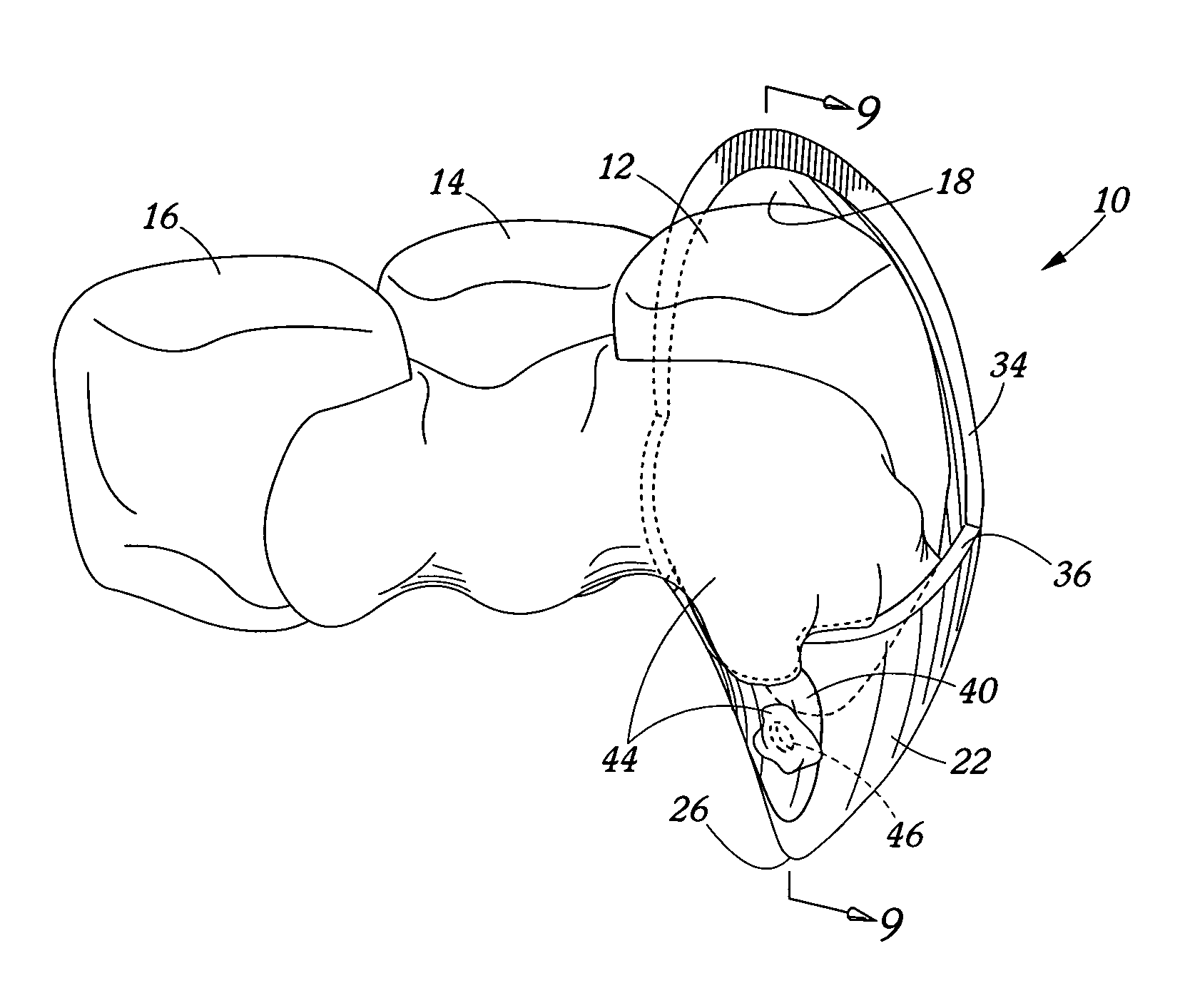 Removable tooth cap and method of attachment therefor
