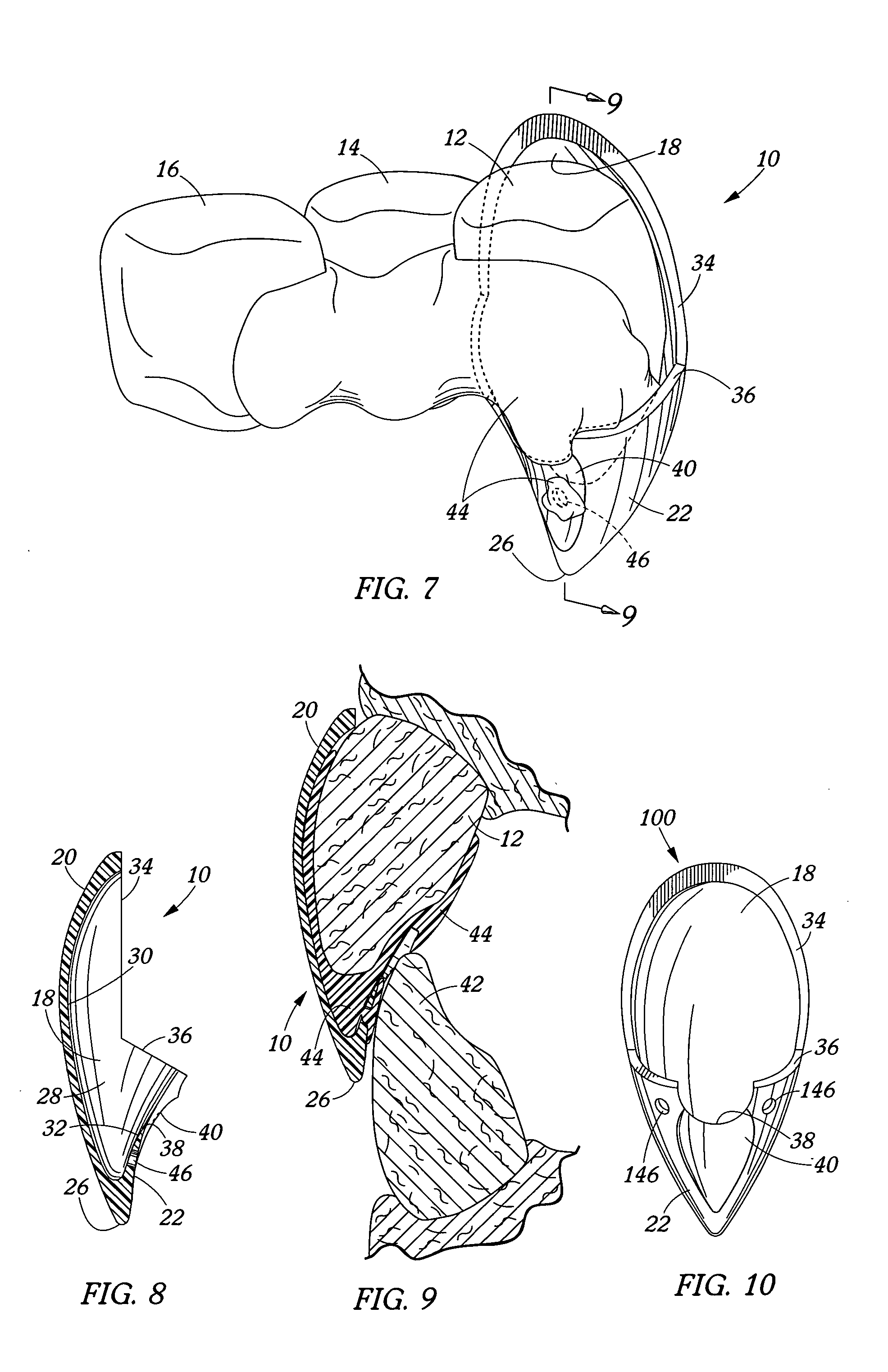 Removable tooth cap and method of attachment therefor