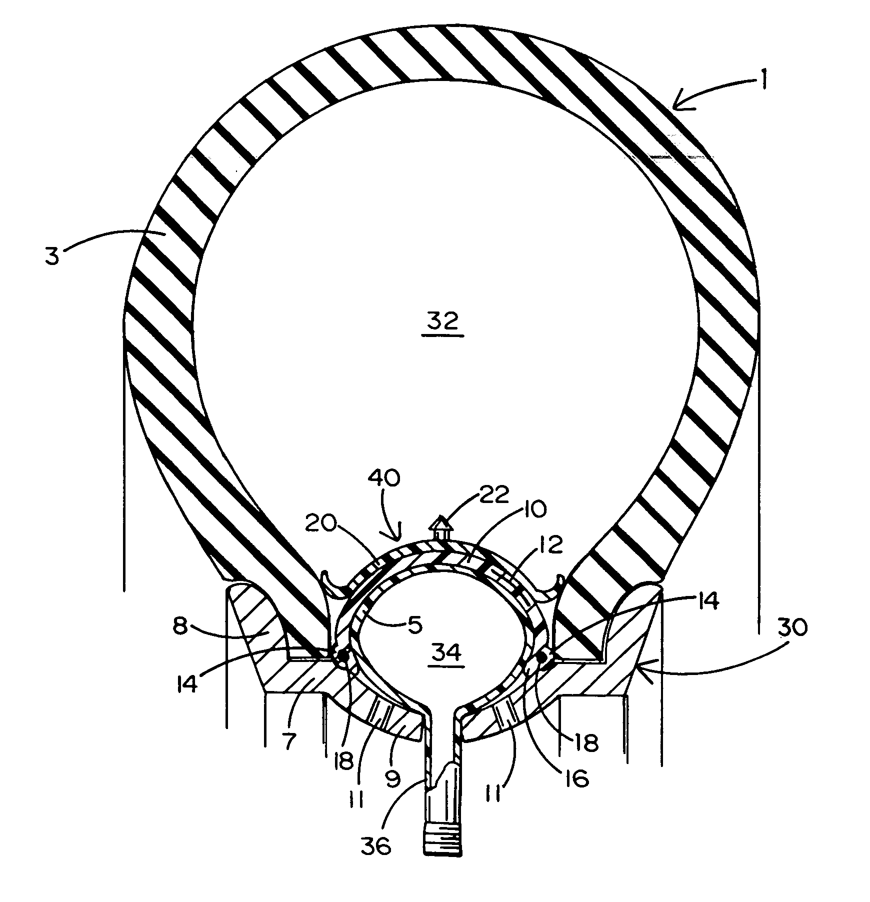 Pneumatic sealing ring having an inner tube and expandable liner for a tube-type tire