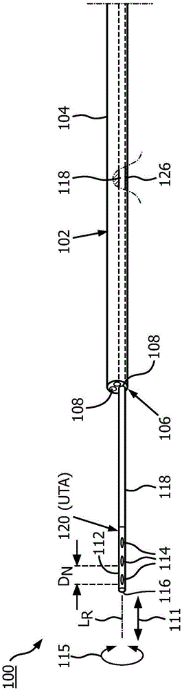 System for performing extraluminal coronary bypass and method of operation thereof
