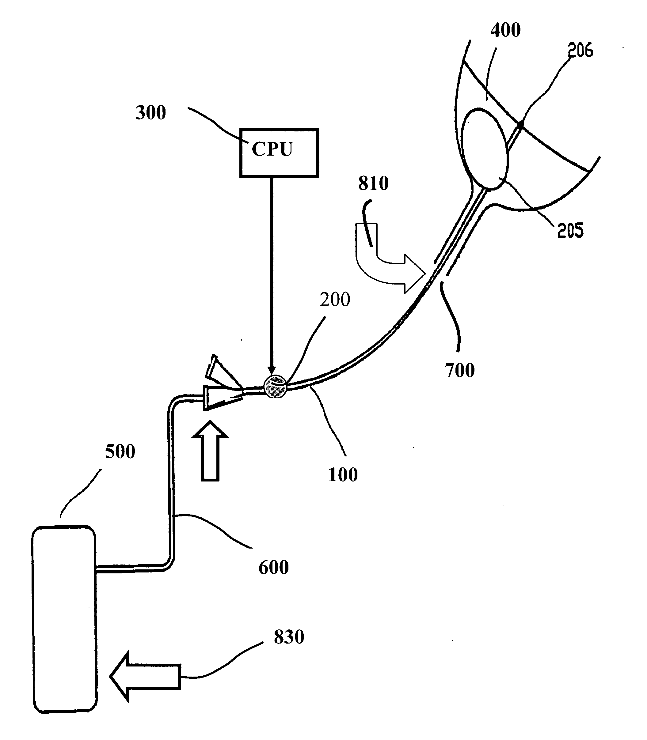 Acoustic add-on device for biofilm prevention in urinary catheter