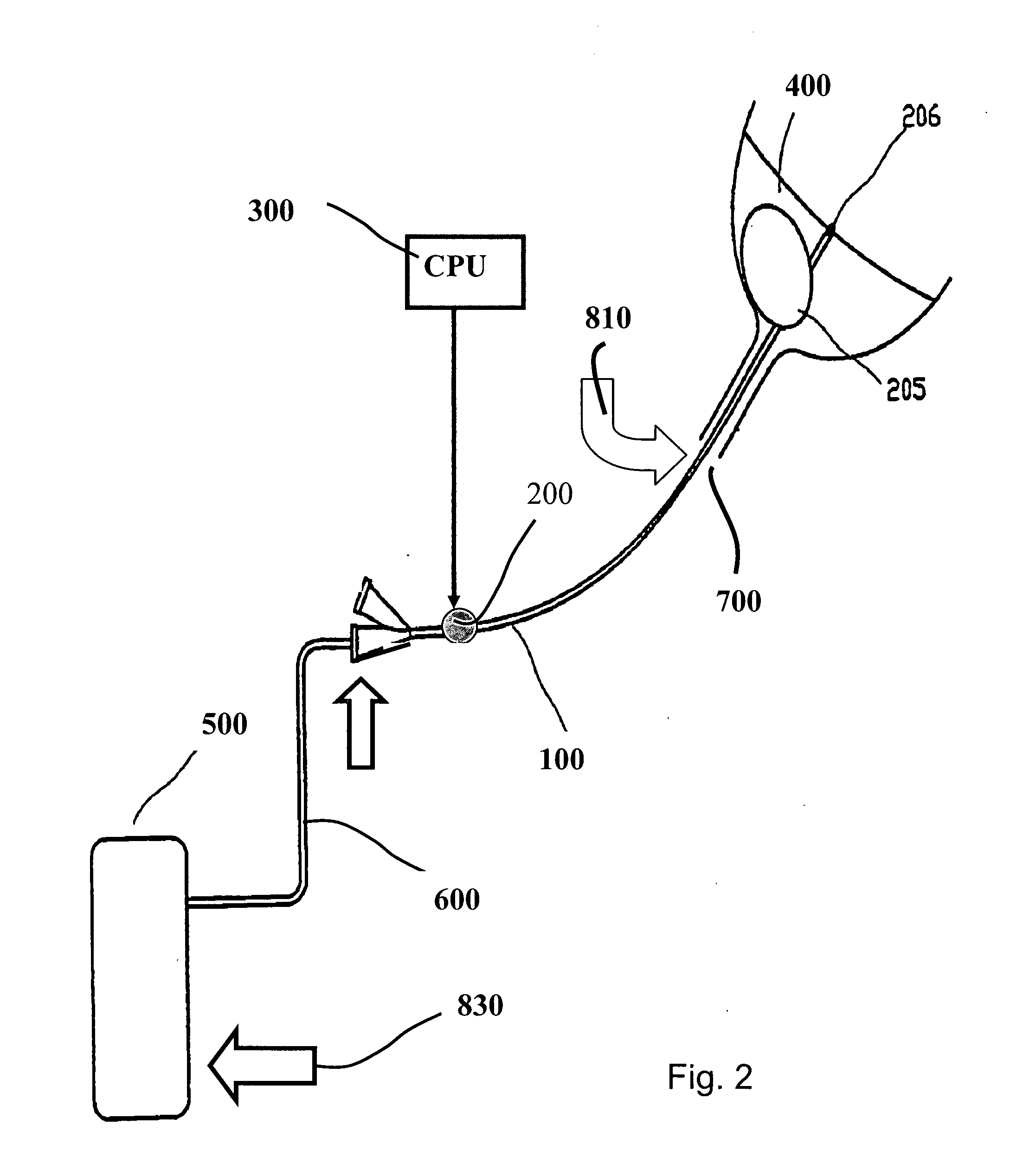 Acoustic add-on device for biofilm prevention in urinary catheter